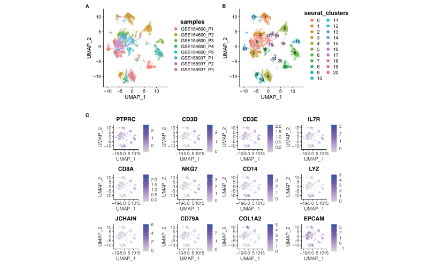 卵巢癌scRNA-seq和bulk RNA-seq结合分析