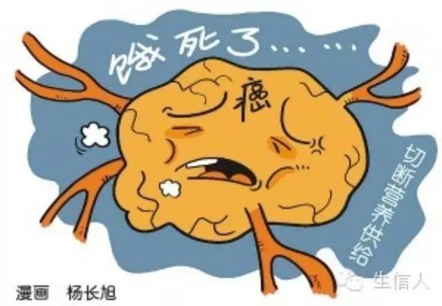 人类有望饿死癌细胞