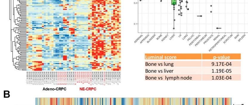 Cancers：纯生信模型构建+免疫组化+动物模型